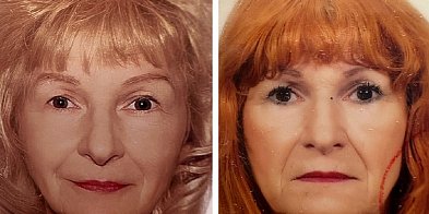 77-latka zaginęła. Pomóż ją odnaleźć-20601